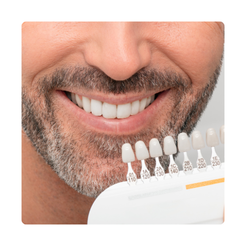 لمینت دندان نازی آباد