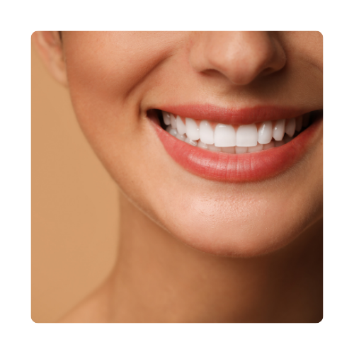 کامپوزیت دندان نازی آباد