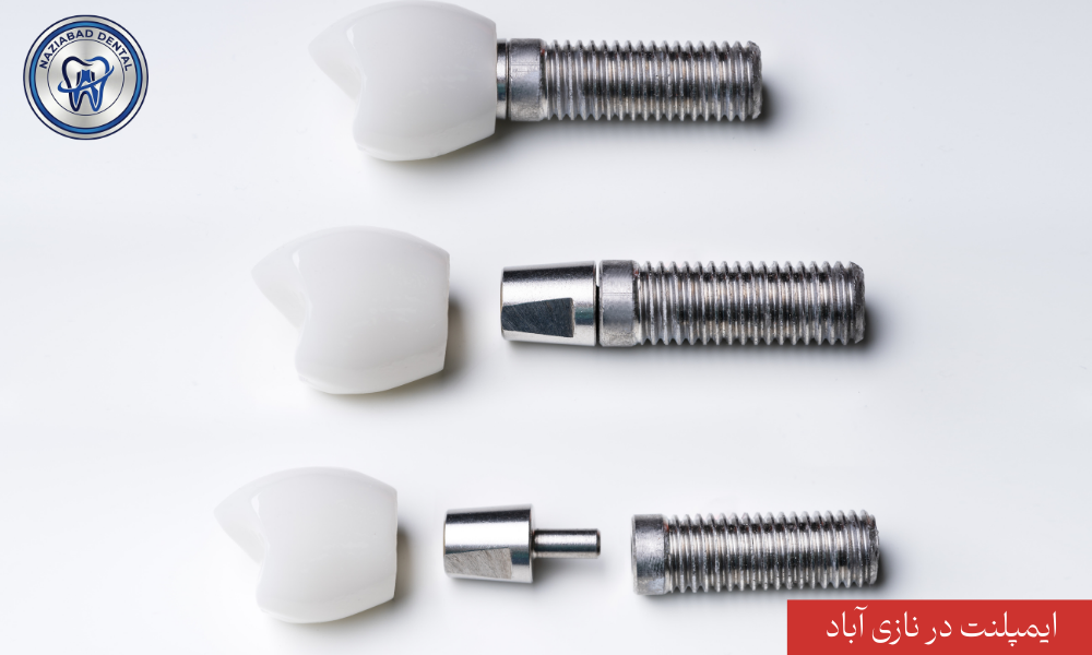 پوشش دهی مناطق جنوب تهران