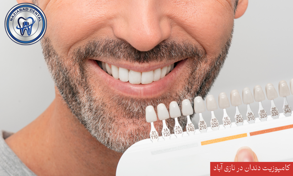 مراحل اجرای کامپوزیت ونیر