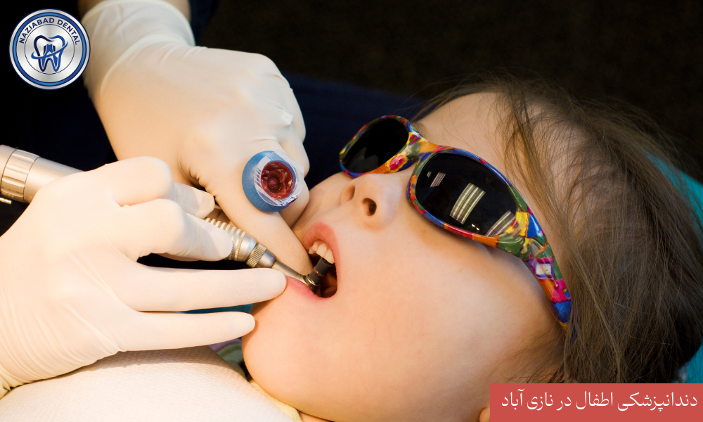 درمان ریشه دندان شیری پالپوتومی و روکش استیل