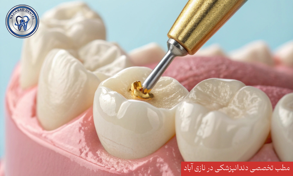 ترمیم دندان با مواد همرنگ در نازی آباد