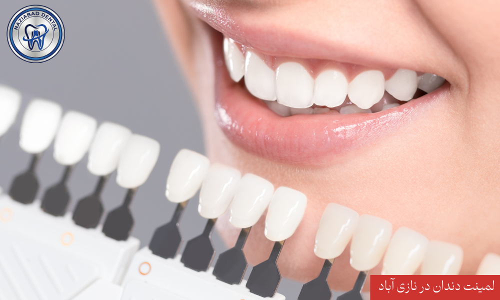 مرکز تخصصی لمینت در نازی آباد