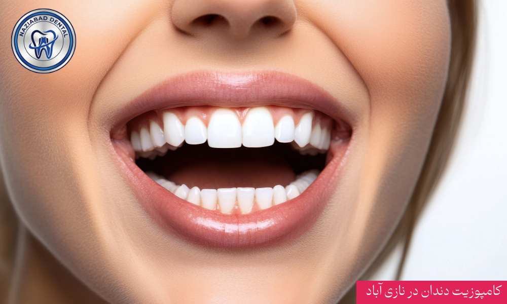 مرکز تخصصی ونیر کامپوزیت در نازی آباد