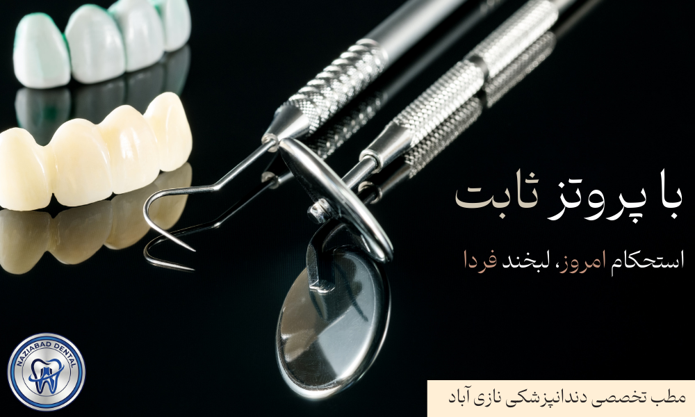 روکش دندان تمام سرامیک و PFM در نازی آباد