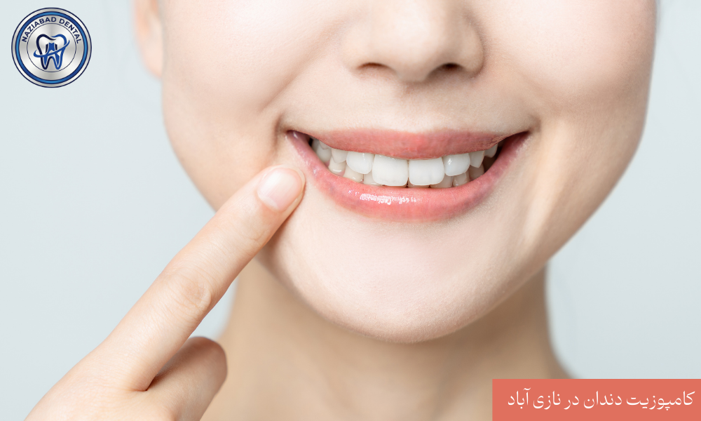انواع کامپوزیت دندان در نازی آباد