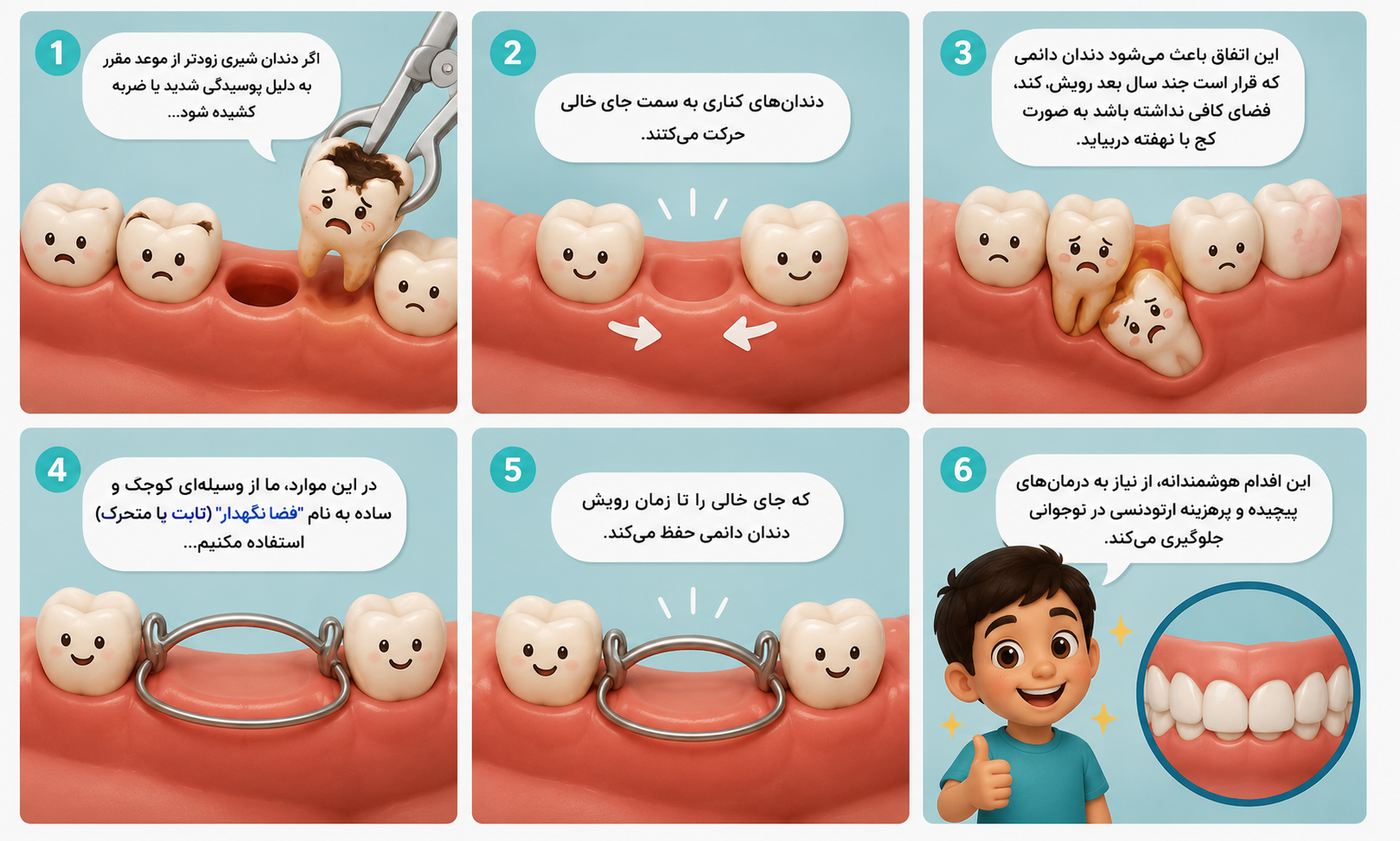 دندانپزشکی کودکان در نازی آباد - فضا نگهدارنده
