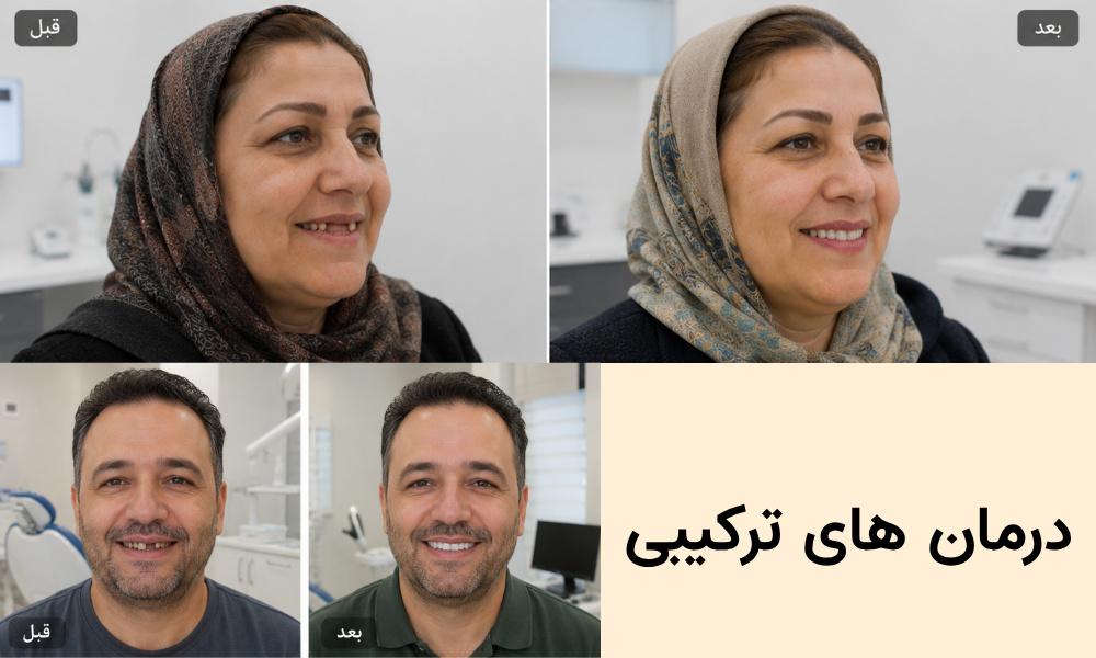 ایمپلنت در نازی آباد تهران - شرایط اقساط منعطف با چک