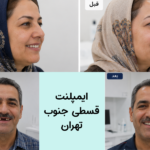 ایمپلنت قسطی جنوب تهران نازی اباد