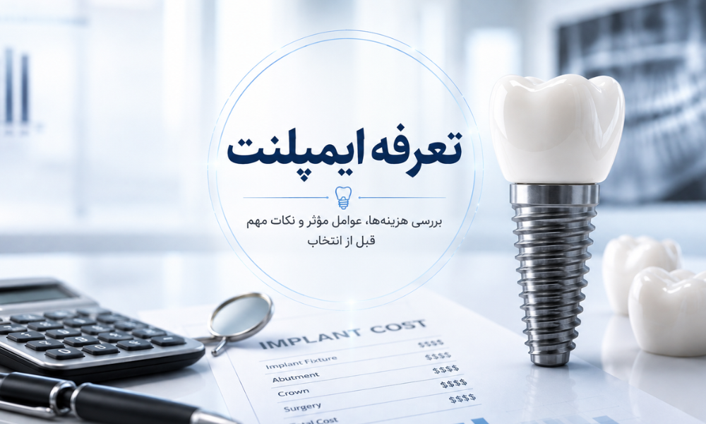 تعرفه دستمزد ایمپلنت