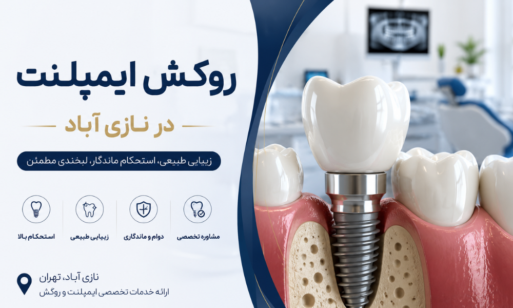 ایمپلنت دندان در نازی آباد - مراحل کاشت و روکش دندان
