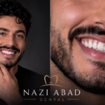 بهترین مرکز لمینت دندان؟