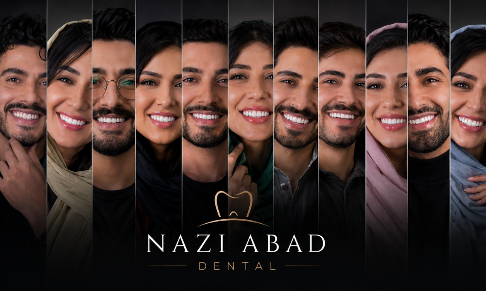 مرکز-کامپوزیت-و-لمینت-در-نازی-آباد-با-25-سال-سابقه-درخشان