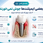 علائم پس زدن ایمپلنت چیست؟  نشانه های جوش نخوردن و شکست ایمپلنت