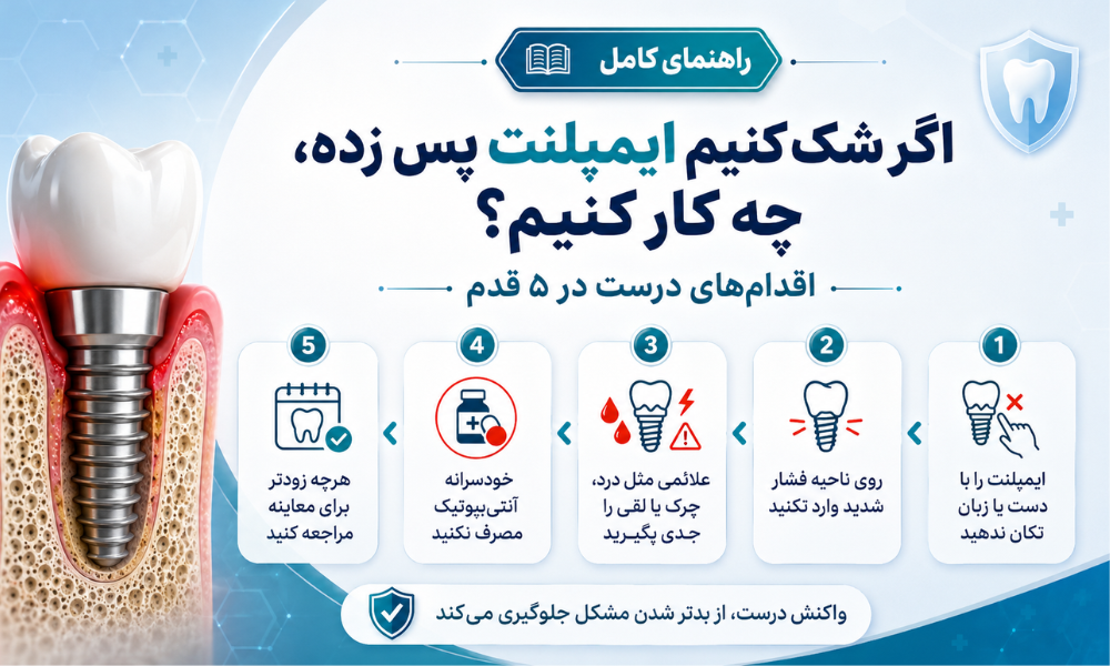 اگر شک کنیم ایمپلنت پس زده چه کار کنیم پنج اقدام مهم
