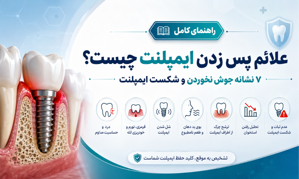 علائم پس زدن ایمپلنت و نشانه های جوش نخوردن و شکست ایمپلنت