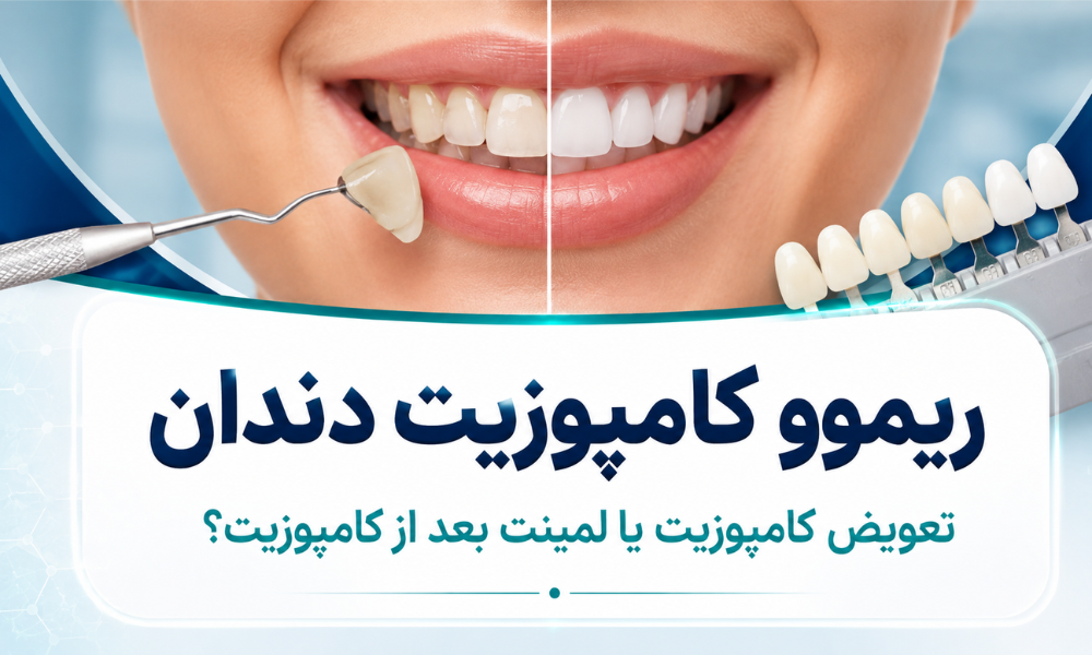 ریموو کامپوزیت دندان و تعویض کامپوزیت یا لمینت بعد از کامپوزیت