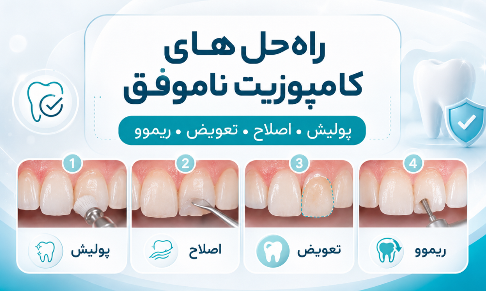 عوارض و معایب کامپوزیت دندان و مشکلات کامپوزیت غیراصولی
