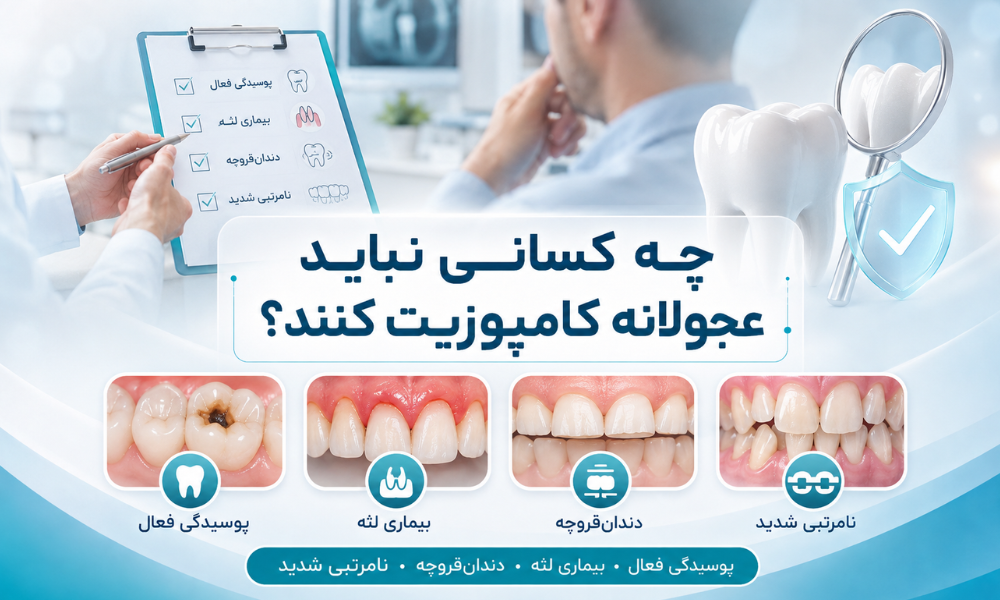 نشانه های کامپوزیت غیراصولی شامل التهاب لثه گیر غذایی لب پریدگی و تغییر رنگ
