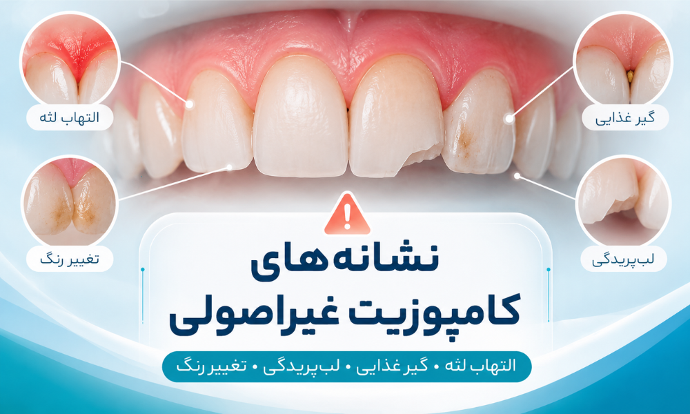 راه حل های کامپوزیت ناموفق شامل پولیش اصلاح تعویض و ریموو کامپوزیت