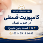 کامپوزیت قسطی در جنوب تهران | ونیر کامپوزیت با پرداخت اقساطی