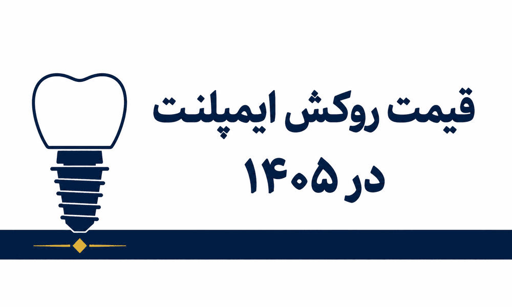 قیمت روکش ایمپلنت ۱۴۰۵ | هزینه پروتز و تاج روی ایمپلنت